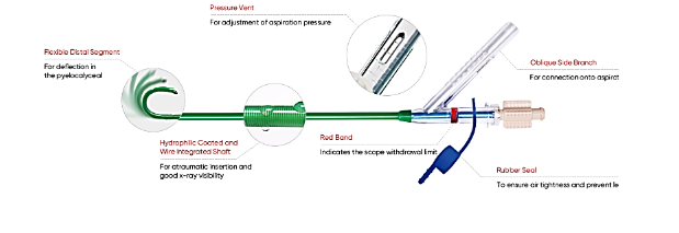 Ureteral Access Sheath – Smooth and Safe Access for Urological Procedures